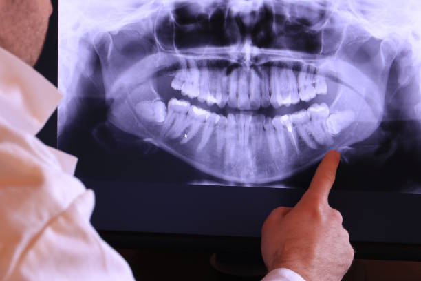 Best Emergency Treatment for Toothache in Stockbridge, MI