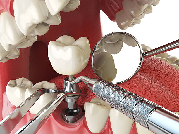 Best Walk-In Emergency Dentist in Stockbridge, MI